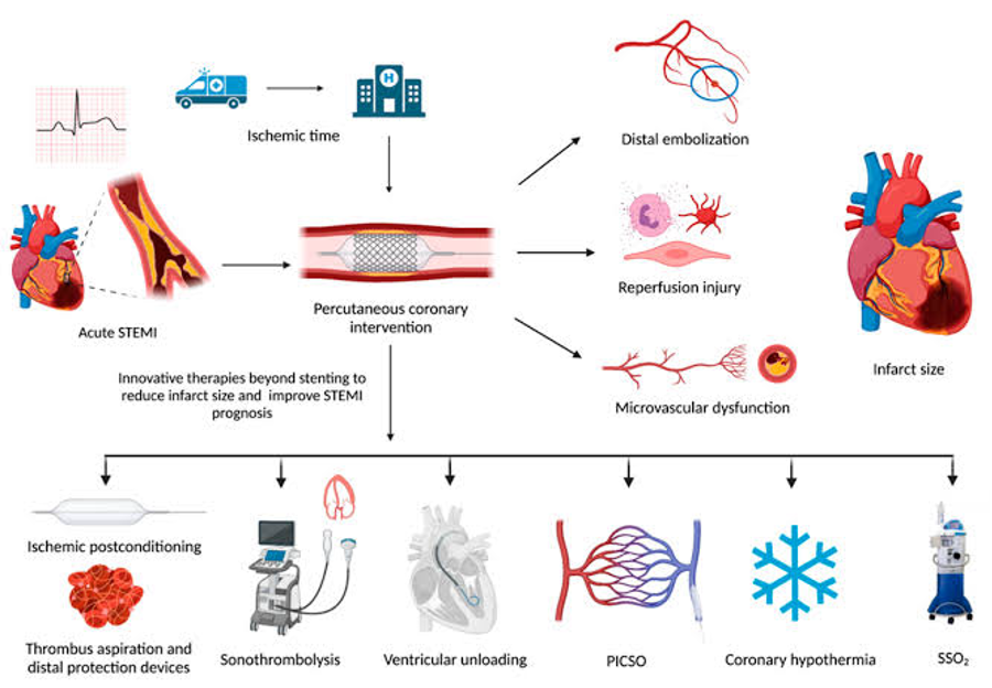 Current Treatments for CAD/ACS and Myocardial Infarction