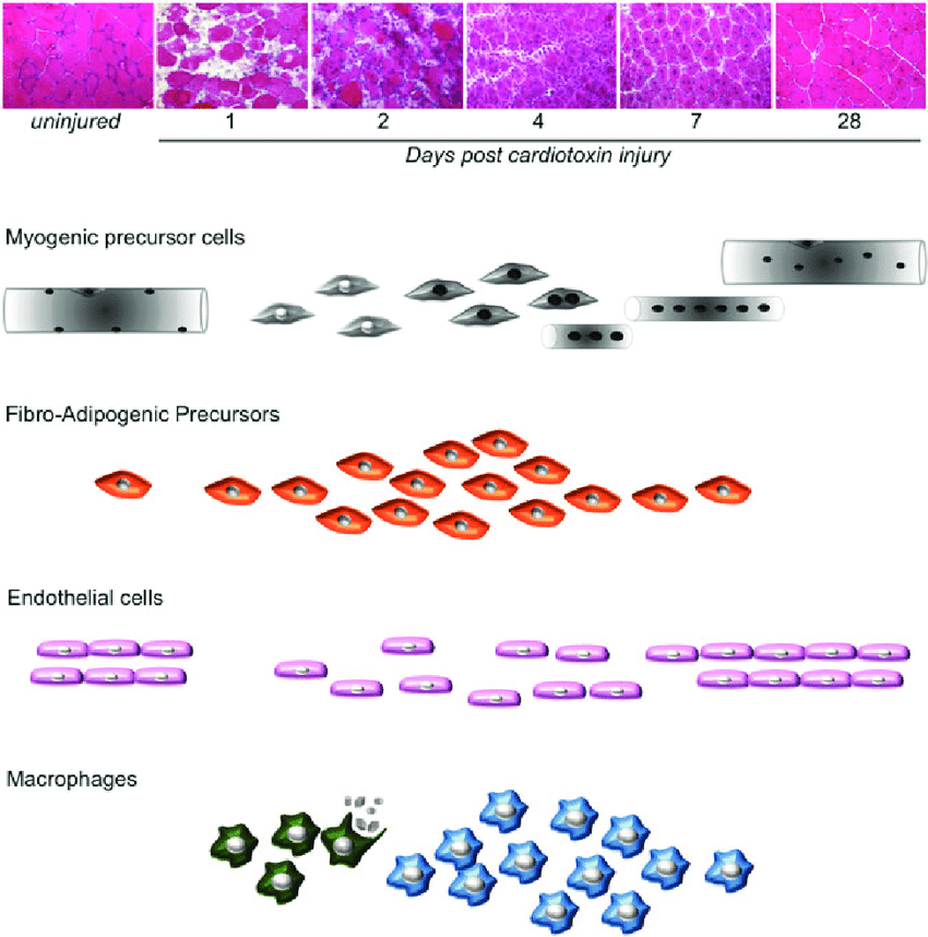 Muscle regeneration in IBM involves a coordinated effort among various cell types, each contributing to the restoration of muscle structure and function.