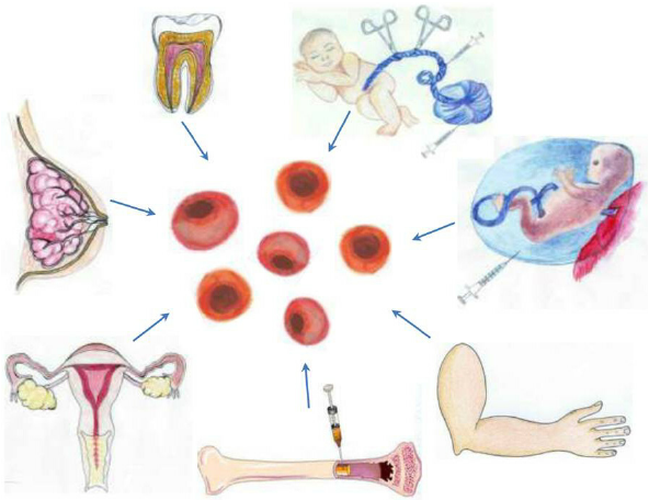 Our Center of Anti-Aging and Regenerative Medicine Center of Thailand advocate for allogeneic enhanced cellular therapy and all the above progenitor stem cell transplants in all patients with Inclusion Body Myositis (IBM) due to several compelling reasons.