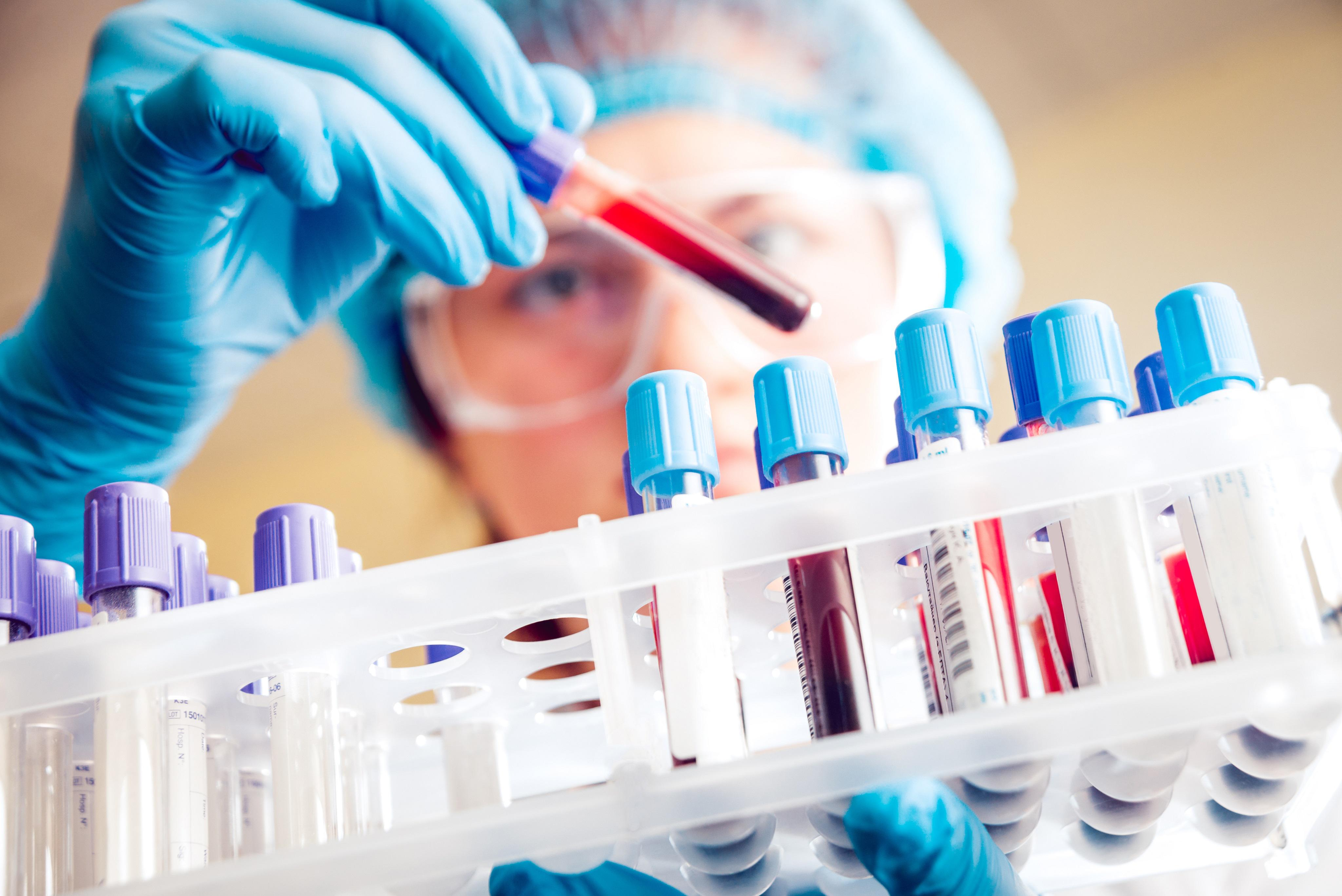 Laboratory Tests: Blood tests may be conducted to assess muscle enzyme levels, including creatine kinase (CK), which may be elevated in individuals with muscle inflammation or damage. 