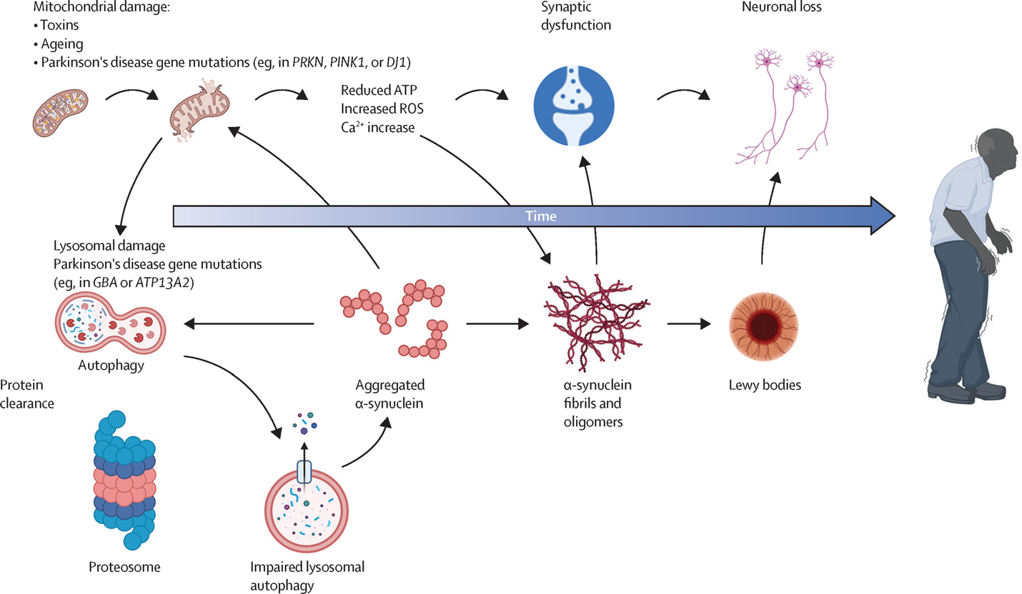 The pathogenesis of Parkinson's disease (PD) involves a complex interaction among various types of brain cells, each playing a distinct role in the progression of the disease