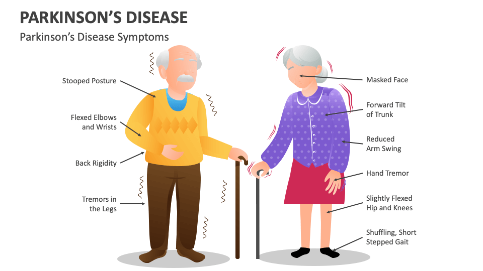 The progression and disability of Parkinson's Disease are attributed to multiple factors, primarily stemming from the loss of dopamine-secreting neurons in the substantia nigra region of the brain. 