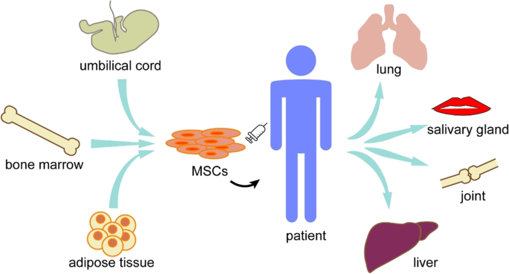 Mesenchymal Stem Cells (MSCs): MSCs help reduce muscle inflammation and promote regeneration of damaged muscle fibers in PM through their anti-inflammatory and regenerative effects.

Research and Clinical Trials: Initial trials suggest improved muscle strength and reduced disease activity in PM patients treated with MSCs.