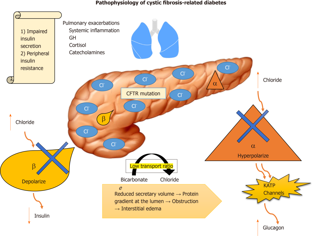 Treatment involves a combination of insulin therapy, nutritional management, and enzyme replacement. Cellular Therapy and Stem Cells for Pancreatic Diseases are being explored to regenerate pancreatic beta cells and improve insulin production in Cystic Fibrosis-Related Diabetes (CFRD) patients.