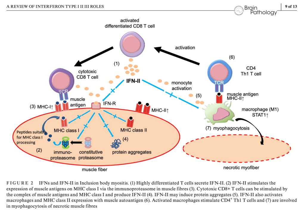 Mesenchymal Stem Cells (MSCs): MSCs have the potential to slow muscle degeneration and reduce inflammation, addressing both autoimmune and degenerative components of IBM.

Research and Clinical Trials: Limited clinical data are available, but early studies suggest that MSC therapy may improve muscle function and delay progression in Inclusion Body Myositis (IBM) patients.