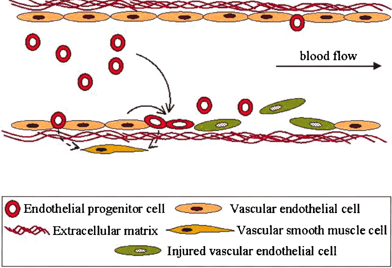 Endothelial Progenitor Stem Cells

- Vascular Repair: These cells can regenerate damaged blood vessels, crucial for conditions like Scleroderma (Systemic Sclerosis) where vascular damage is prominent.

- Improved Blood Flow: Improved vascular function and reduced symptoms have been observed in preclinical and clinical models.