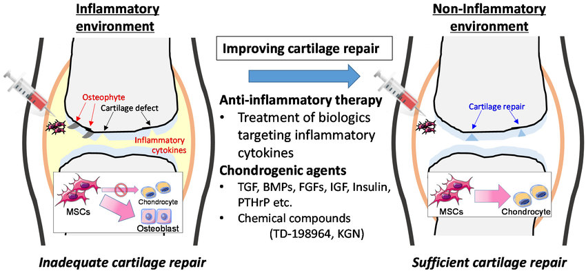  Research and Clinical Trials: Early clinical trials have shown that intra-articular injection of MSCs in Rheumatoid Arthritis (RA) patients leads to significant improvement in joint function and reduction in disease activity. Patients reported decreased pain and increased mobility.