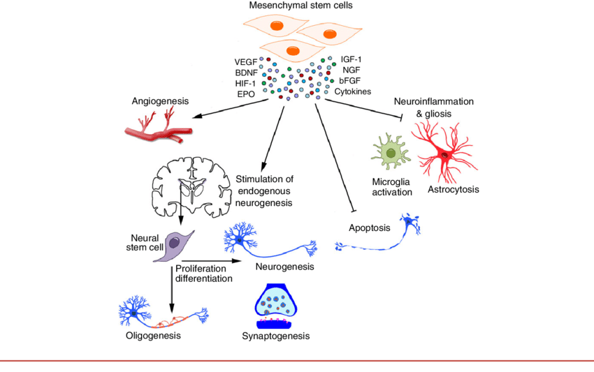 - MSCs and Neural Progenitor Stem Cells: These cells can help repair neural damage and modulate immune responses, addressing the chronic fatigue and neurological symptoms of CFS.

- Preclinical and Clinical Studies: Research and Clinical Trials have indicated that Cellular Therapy and Stem Cells for Autoimmune and Connective Tissue Diseases can improve energy levels and reduce fatigue.