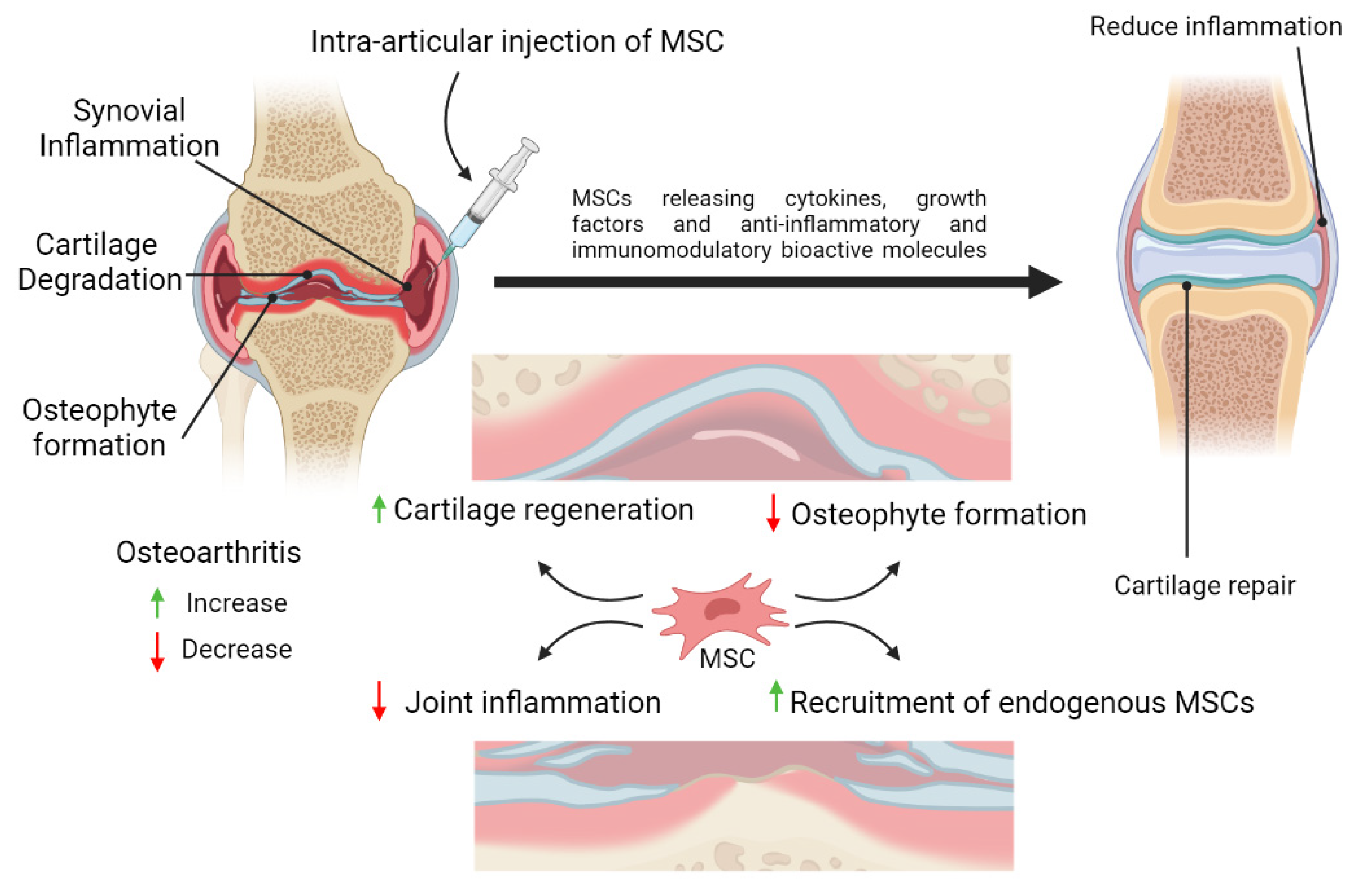 Rheumatoid Arthritis (RA):

- Research and Clinical Trials: Intra-articular injections of Mesenchymal Stem Cells (MSCs) have shown to improve joint function and reduce inflammation. Patients report decreased pain and enhanced mobility.

- Mechanism: MSCs regenerate cartilage and release anti-inflammatory cytokines, which reduce joint inflammation and slow disease progression in Rheumatoid Arthritis (RA) patients.