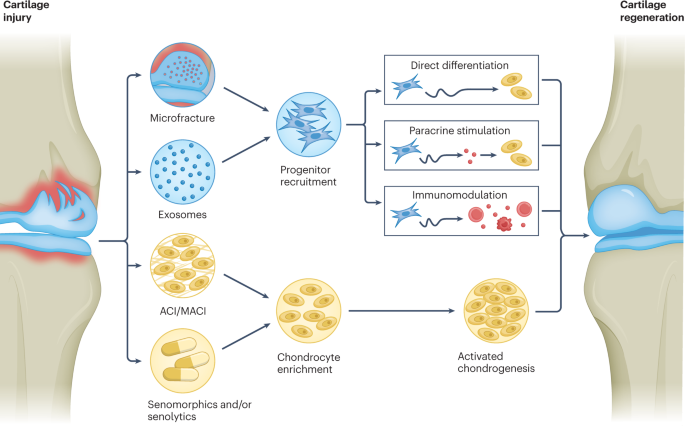 Cartilage Regeneration (RA): Mesenchymal stem cells (MSCs) can differentiate into chondrocytes (cartilage cells), aiding in the repair of damaged joint cartilage in rheumatoid arthritis.