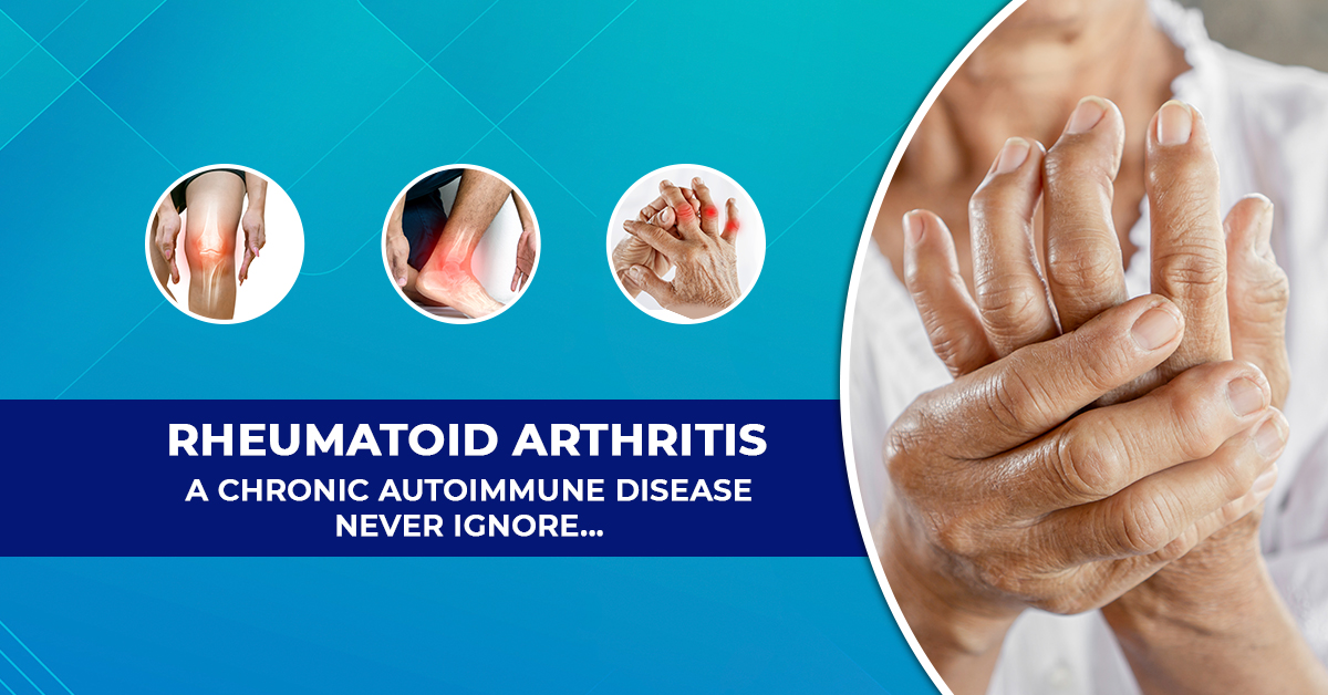 Rheumatoid Arthritis (RA)

- Prevalence: RA affects about 1% of the global population, with a higher prevalence in women than men.

- Economic Impact: In the U.S., the annual direct medical cost for a patient with RA can range from $10,000 to $30,000. Indirect costs, including lost productivity, are estimated to be up to $19,000 per year per patient.

- Disability: Up to 50% of RA patients are unable to work within 10 years of disease onset.