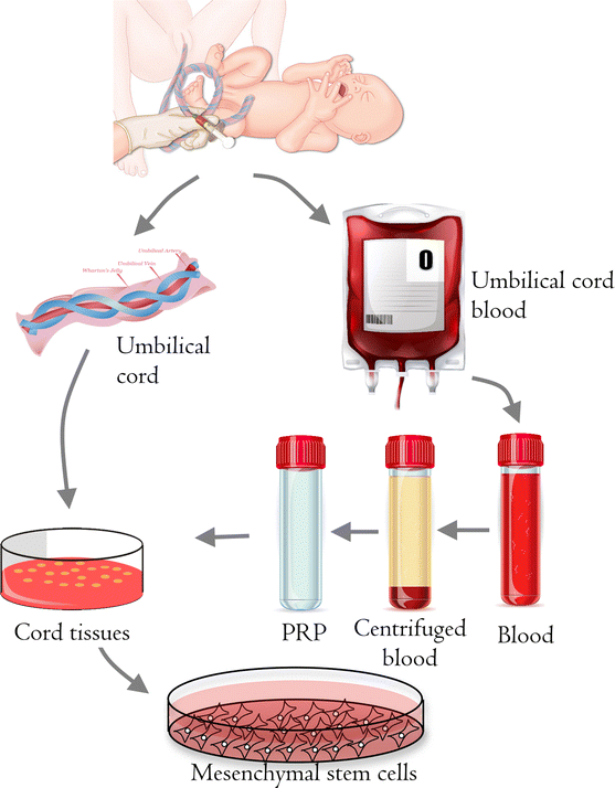 Umbilical Cord Blood is a rich source of both hematopoietic stem cells (HSCs) and Mesenchymal Stem Cells (MSCs). It is collected non-invasively at birth and stored in cord blood banks.