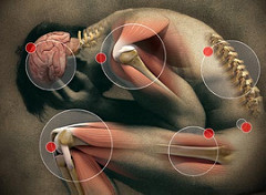 Fibromyalgia (FM)

- Prevalence: FM affects about 2-4% of the global population, with a higher prevalence in women.

- Quality of Life: Chronic widespread pain, fatigue, and cognitive difficulties significantly impair quality of life.

- Economic Impact: High healthcare costs and lost productivity contribute to a substantial economic burden.