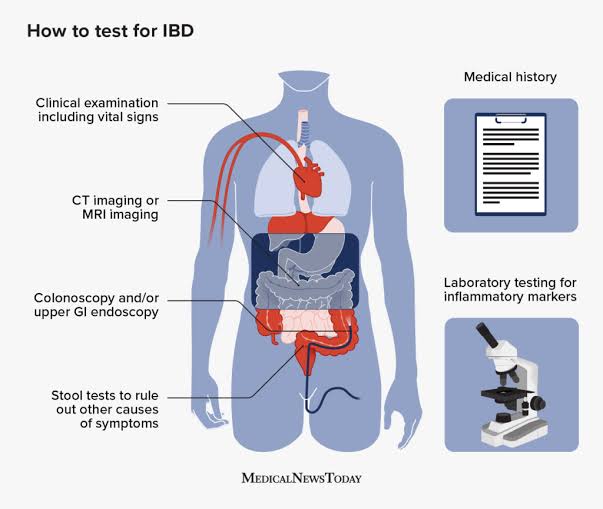 Revolutionizing Gastrointestinal Disorder Management: Innovative Approaches and Advanced Monitoring by Our Expert Team of Anti-Aging and Regenerative Medicine Center of Thailand