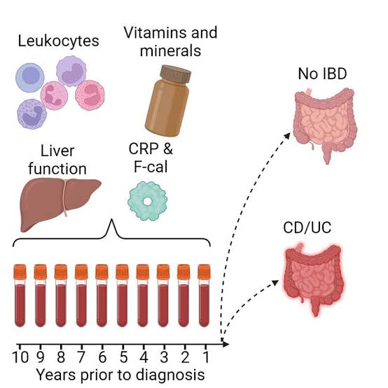 Improvement after our Cellular Therapy and Stem Cells for Digestive Tract Diseases is indicated by stabilization or improvement in markers such as inflammatory markers (e.g., CRP), fecal calprotectin, and other relevant biomarkers.