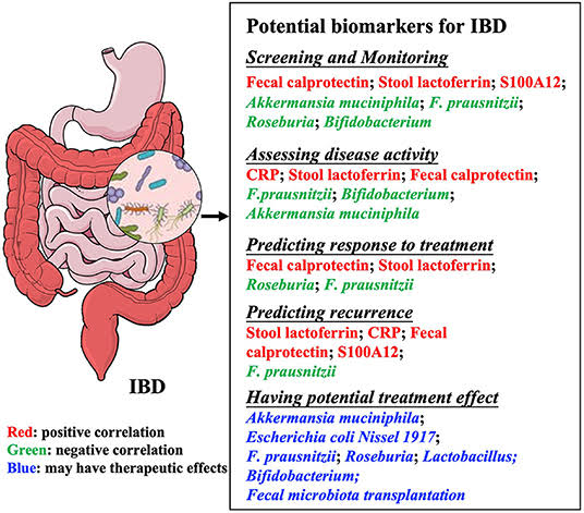 Crohn’s Disease
C-reactive protein (CRP)

- Fecal calprotectin

- Serum albumin levels

- Endoscopic findings (mucosal inflammation, ulceration, strictures)

- Crohn's Disease Activity Index (CDAI)