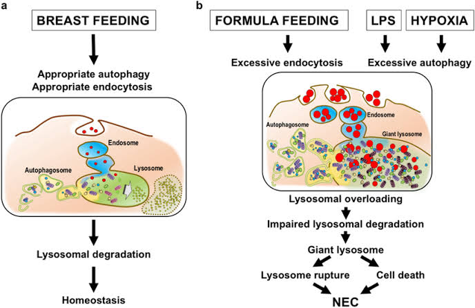 Lifestyle adaptations are tailored to fortify gut health and bolster immune function in infants grappling with NEC.