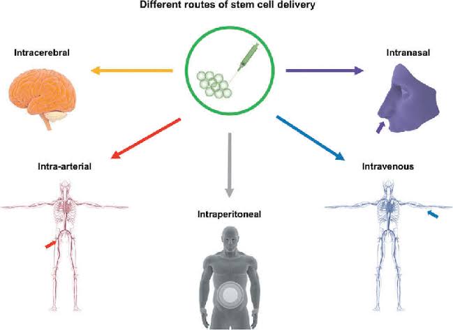 Our team of gastroenterologists, regenerative specialists, and stem cell scientists is at the forefront of developing innovative strategies to enhance Cellular Therapy and Stem Cell delivery specifically to the gastrointestinal tract for therapeutic purposes.