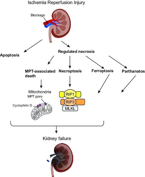 Renal Ischemia-Reperfusion (IR) Injury:

- IR injury, occurring in various clinical contexts such as transplantation and surgery, contributes to significant renal morbidity and mortality.

- Strategies aimed at mitigating IR injury, including pharmacological interventions and surgical techniques, remain areas of active Clinical Trials, Research and Development.