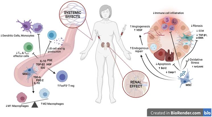 Our Cellular Therapy and Stem Cells for Kidneys and Renal Diseases such as Chronic Kidney Diseases (CKD), Diabetic Nephropathy (DN), Familial Focal Segmental Glomerulosclerosis (fFSGS), Polycystic Kidney Disease (PKD), Acute Kidney Injury (AKI) ,Glomerulonephritis (GN), Alport Syndrome (AS), Lupus Nephritis (LN), Nephrotic Syndrome (NS), Kidney Cysts, Renal Ischemia-Reperfusion (IR) Injury, Acute and Chronic Kidney Failure, End-Stage Renal Disease (ESRD), Renal Fibrosis enact their therapeutic effects through a multifaceted repertoire of mechanisms, encompassing cellular differentiation, secretion of trophic factors promoting tissue regeneration, immune modulation, and suppression of inflammation and fibrosis within the kidneys.