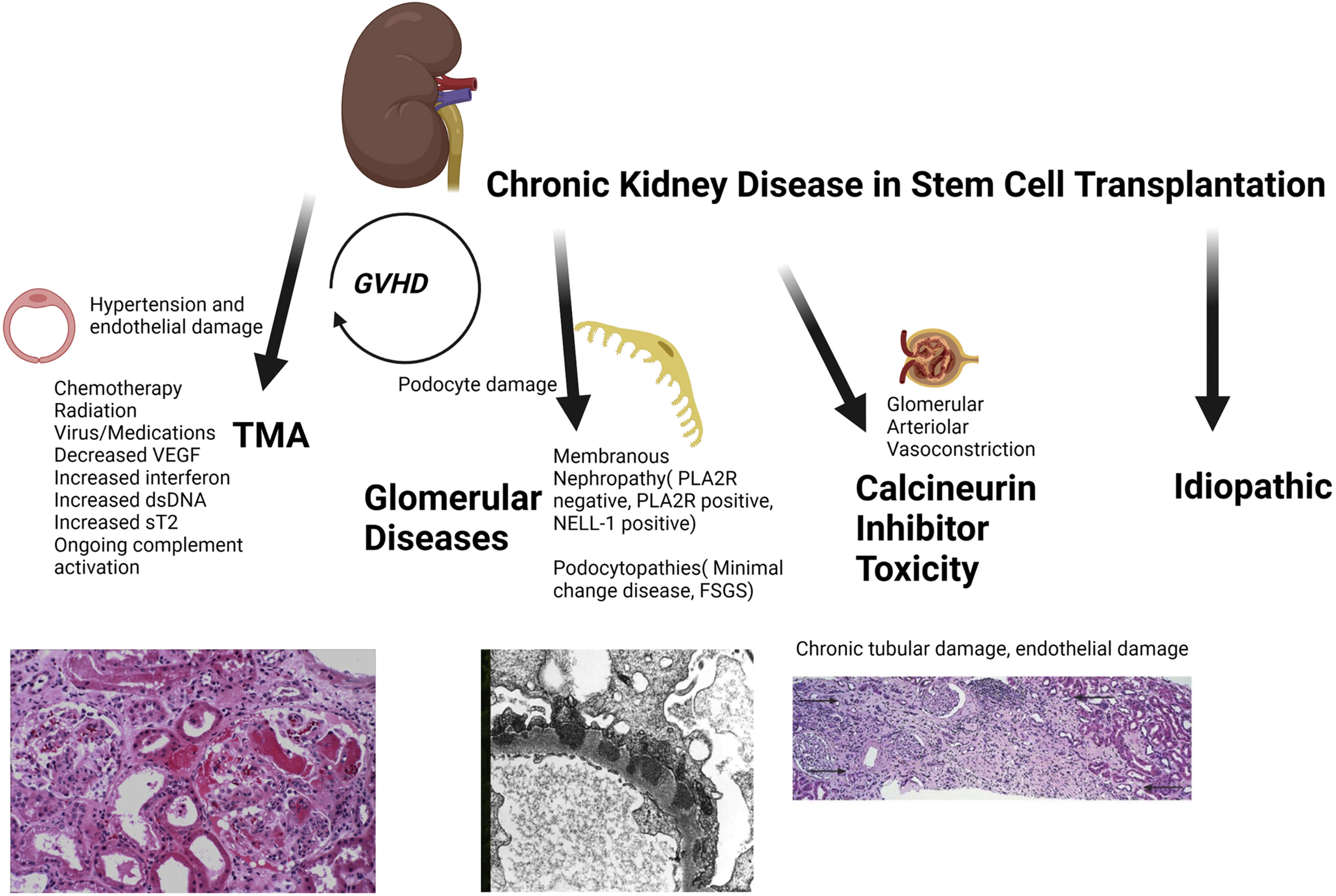 Chronic Kidney Diseases (CKD):

- CKD is a progressive condition characterized by the gradual loss of kidney function, affecting millions worldwide.

- Preliminary Research and Clinical Trials suggests that renal tubular epithelial progenitor stem cells (RTE-PSCs) hold promise for CKD treatment by promoting tubular repair and regeneration.

- Clinical trials exploring the safety and efficacy of RTE-PSC therapy in CKD patients are underway, offering hope for improved outcomes and disease management.