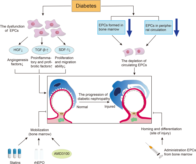 Diabetic Nephropathy (DN):

- DN, a common complication of diabetes, is a leading cause of CKD and end-stage renal disease (ESRD).

- Studies have shown that podocyte progenitor stem cells (PC-PSCs) may mitigate the progression of DN by enhancing podocyte repair and reducing glomerular damage.

- Early Research and Clinical Trials investigating PC-PSC therapy for DN have reported encouraging results, supporting further exploration of these approaches in larger patient populations.