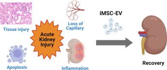 Acute Kidney Injury (AKI):

- AKI is a sudden loss of kidney function, often occurring in response to acute insults such as ischemia, toxins, or infections.

- Mesenchymal stem cells (MSCs) and renal tubular epithelial progenitor stem cells (RTE-PSCs) have shown promise in preclinical models of AKI by promoting renal repair, reducing inflammation, and improving kidney function.

- Early Research and Clinical Trials investigating the use of Mesenchymal Stem Cells (MSCs) and RTE-PSCs for AKI have demonstrated potential benefits, including improved renal recovery and reduced mortality rates, underscoring the therapeutic potential of these approaches for AKI management.