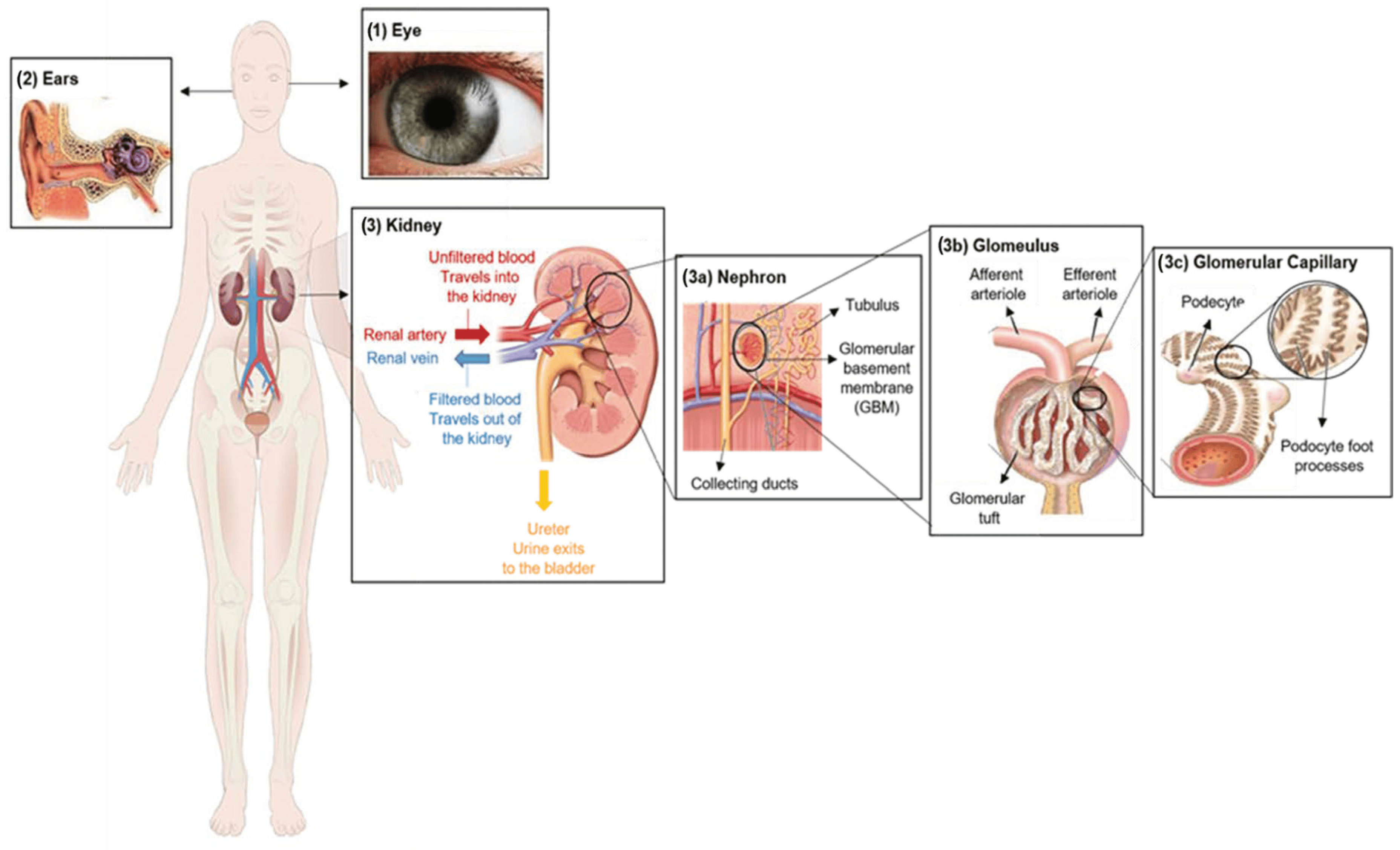 Alport Syndrome (AS):

- AS is a genetic disorder characterized by progressive renal impairment, often leading to end-stage renal disease (ESRD) in affected individuals.

- Although Research and Clinical Trials into Cellular Therapy and Stem Cells for AS is limited, preliminary studies suggest that renal progenitor stem cells (Renal PSCs) may offer potential therapeutic benefits by promoting renal repair and regeneration.

- Preclinical investigations exploring the use of Renal PCs in AS animal models have shown encouraging results, supporting further research into their clinical utility for AS patients.