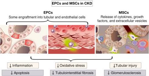 - Cellular Therapy and Stem Cells for Kidneys and Renal Diseases utilizing Renal PSCs and other progenitor stem cells aims to attenuate renal fibrosis, preserve nephron function, and delay CKD progression, offering hope for improved renal outcomes and quality of life in affected individuals.