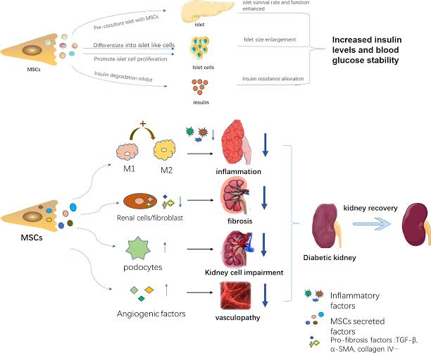 Diabetic Nephropathy (DN):

- Renal progenitor cell-based interventions, including RTE-PSCs and GEC-PSCs, seek to mitigate glomerular damage, reduce albuminuria, and improve renal function in diabetic nephropathy patients, addressing a significant cause of end-stage renal disease worldwide.