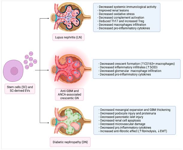 Lupus Nephritis (LN):

- Cellular Therapy and Stem Cells for Kidneys and Renal Diseases utilizing Renal PSCs and PC-PSCs seeks to ameliorate renal inflammation, preserve glomerular function, and attenuate disease activity in lupus nephritis, providing a potential adjunctive therapy for this autoimmune-mediated renal disorder.