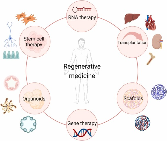 Revolutionizing Renal Regeneration: Our Advanced Cellular Therapy Protocols with Renal Progenitor Stem Cells (R-PSCs)

Our special treatment protocols of Cellular Therapy and Stem Cells for Kidneys and Renal Diseases such as Chronic Kidney Diseases (CKD), Diabetic Nephropathy (DN), Familial Focal Segmental Glomerulosclerosis (fFSGS), Polycystic Kidney Disease (PKD), Acute Kidney Injury (AKI) ,Glomerulonephritis (GN), Alport Syndrome (AS), Lupus Nephritis (LN), Nephrotic Syndrome (NS), Kidney Cysts, Renal Ischemia-Reperfusion (IR) Injury, Acute and Chronic Kidney Failure, End-Stage Renal Disease (ESRD), Renal Fibrosisusing Renal Progenitor Stem Cells (R-PSCs) at our DrStemCellsThailand's Anti-Aging and Regenerative Medicine Center of Thailand stand out from others due to several key factors: