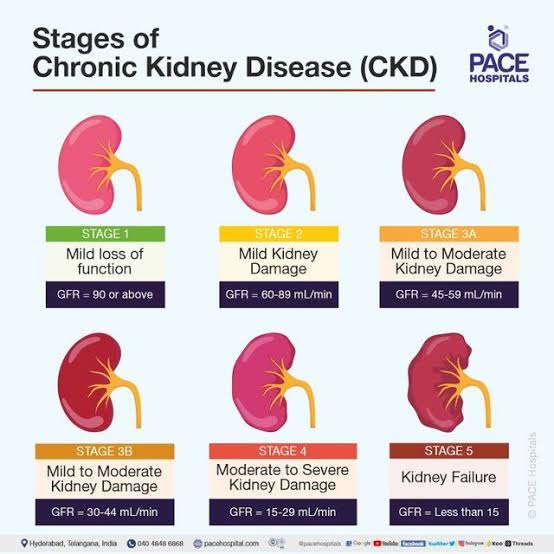 Chronic Kidney Diseases (CKD):

- CKD affects approximately 10% of the global population, with prevalence rates varying across regions and demographics.

- With an estimated 1 in 7 adults worldwide suffering from CKD, it stands as a significant contributor to the global burden of disease.

- Diabetes and hypertension remain the leading causes of CKD, accounting for a substantial portion of cases.