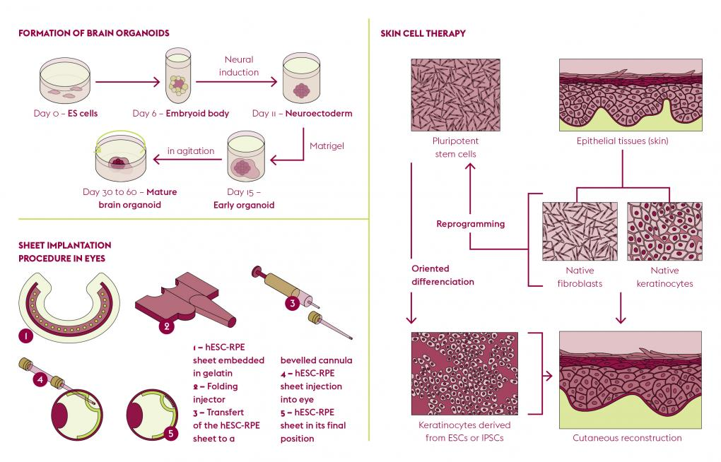 Cutting-Edge Cell Culture Techniques: Leveraging advanced cell culture methods at DrStemCellsThailand's Anti-Aging and Regenerative Medicine Center of Thailand, we isolate, expand, and characterize Pancreatic Islet Beta-Cell Progenitor Stem Cells (PIBC-PSCs) with precision.