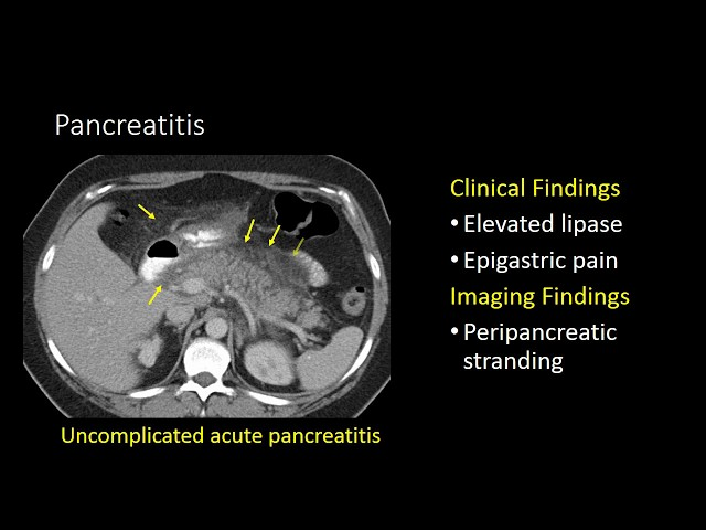 maging Studies: We utilize various imaging modalities to visualize the pancreas and assess its structure and function. This includes abdominal ultrasound, computed tomography (CT) scans, magnetic resonance imaging (MRI), and endoscopic retrograde cholangiopancreatography (ERCP). 