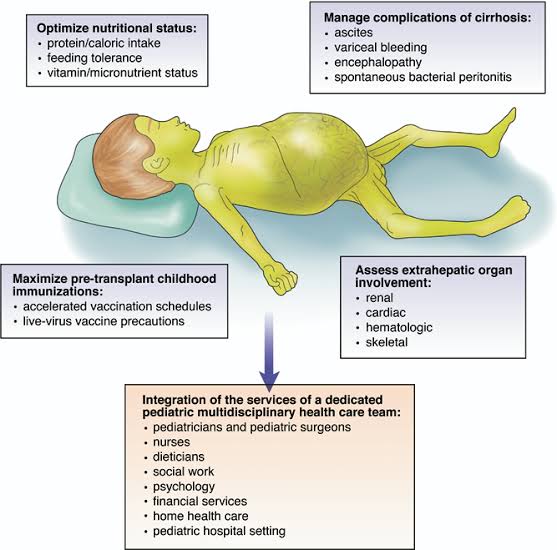 Acute liver failure and decompensated chronic liver failure have high mortality rates, and liver transplantation remains the only definitive treatment option in many cases. 