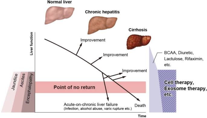 our Cellular Therapy and Stem Cells for Liver Diseases using progenitor stem cells can prevent the progression of liver disease to end-stage liver failure, thus improving patient outcomes and reducing the need for liver transplantation. 