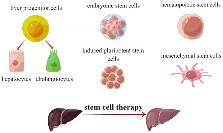 Our Cellular Therapy and Stem Cells for Liver Diseases Show Promise for Liver Regeneration in Hepatobiliary Diseases: Preclinical and Early Clinical Evidence Across Biliary Atresia, Cirrhosis, Hepatitis, Liver Failure, Liver Fibrosis, Primary Biliary Cirrhosis, and Primary Sclerosing Cholangitis 