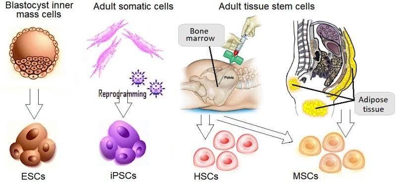 Diverse Sources for Liver Progenitor Stem Cells as part of our special treatment protocols of Cellular Therapy and Stem Cells for Liver Diseases: A Path to Enhanced Regenerative Therapies