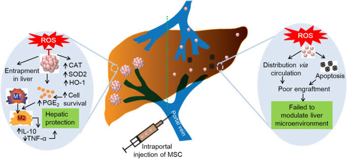 strategies have been developed to improve the delivery of Cellular Therapy and Stem Cells for Liver Diseases specifically to the liver at our center of Anti-Aging and Regenerative Medicine Center of Thailand