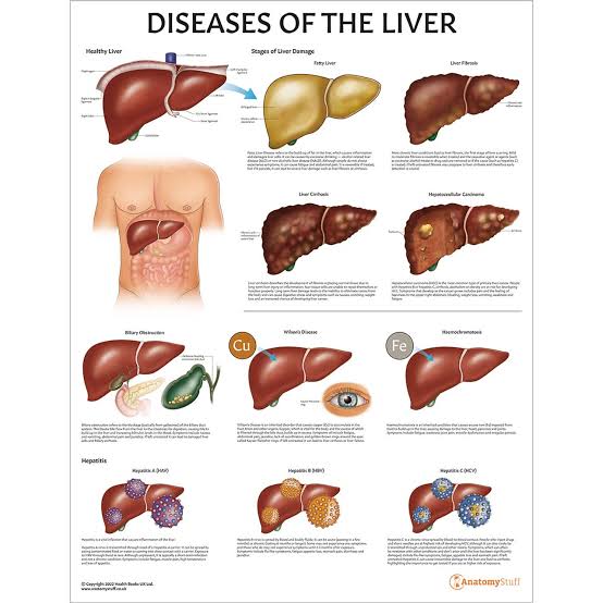 Key Statistics and Insights on Biliary Atresia, Cirrhosis, Hepatitis, and More Before our Special Treatment Protocols of Cellular Therapy and Stem Cells for Liver Diseases at our DrStemCellsThailand's Anti-Aging and Regenerative Medicine Center of Thailand