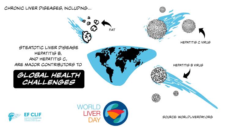 Challenges in Managing Various Chronic Liver Conditions: Navigating Complexities and Advancing Treatments